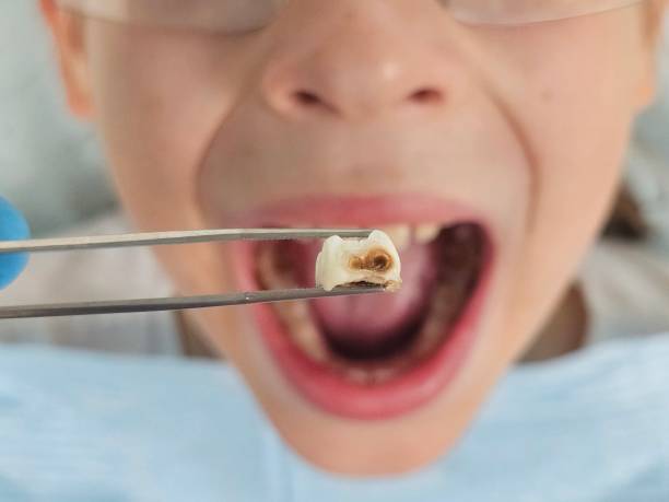 Professional Emergency Dentist in MO
